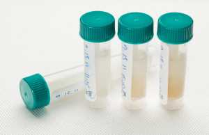 samples for laboratory test